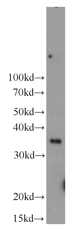 Y79 cells were subjected to SDS PAGE followed by western blot with Catalog No:113399(NTHL1 antibody) at dilution of 1:1000