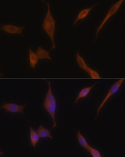 Immunofluorescence - MLPH Polyclonal Antibody 