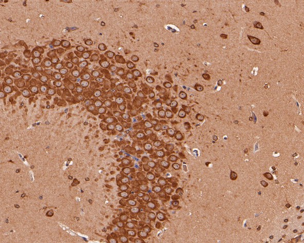 Fig4:; Immunohistochemical analysis of paraffin-embedded mouse brain tissue using anti-KCNQ4 antibody. The section was pre-treated using heat mediated antigen retrieval with Tris-EDTA buffer (pH 8.0-8.4) for 20 minutes.The tissues were blocked in 5% BSA for 30 minutes at room temperature, washed with ddH; 2; O and PBS, and then probed with the primary antibody ( 1/50) for 30 minutes at room temperature. The detection was performed using an HRP conjugated compact polymer system. DAB was used as the chromogen. Tissues were counterstained with hematoxylin and mounted with DPX.