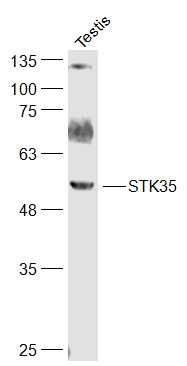 Fig1: Sample:; Testis(Rat) Cell Lysate at 40 ug; Primary: Anti-STK35 at 1/300 dilution; Secondary: IRDye800CW Goat Anti-Rabbit IgG at 1/20000 dilution; Predicted band size: 58 kD; Observed band size: 58 kD