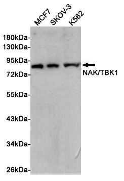 Western blot analysis of extracts from MCF7, SKOV-3 and K562 cells using NAK/TBK1 (N-term) Rabbit pAb at 1:1000 dilution. Predicted band size: 84kDa. Observed band size: 84kDa.
