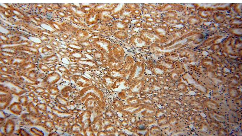 Immunohistochemical of paraffin-embedded human kidney using Catalog No:111147(GPT2 antibody) at dilution of 1:100 (under 10x lens)