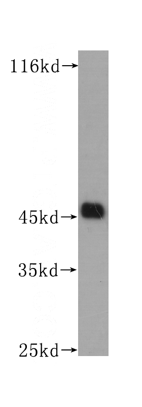 Raji cells were subjected to SDS PAGE followed by western blot with Catalog No:107047(CD1A antibody) at dilution of 1:300