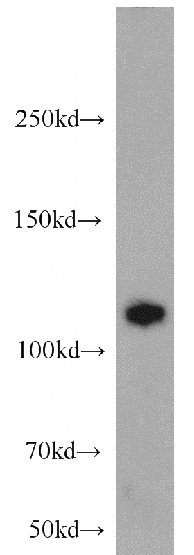 K-562 cells were subjected to SDS PAGE followed by western blot with Catalog No:114492(ZFYVE20 antibody) at dilution of 1:1000