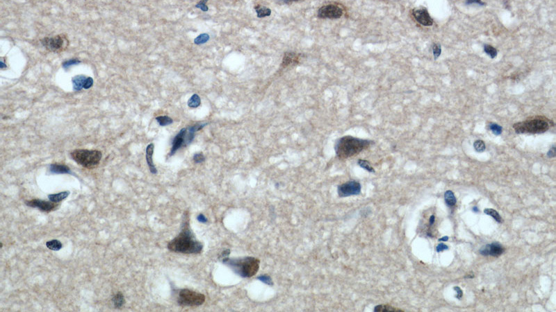 Immunohistochemical of paraffin-embedded human brain using Catalog No:115903(TCERG1 antibody) at dilution of 1:50 (under 40x lens)