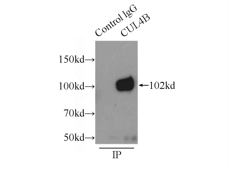 IP Result of anti-CUL4B (IP:Catalog No:109746, 3ug; Detection:Catalog No:109746 1:1000) with HeLa cells lysate 4650ug.