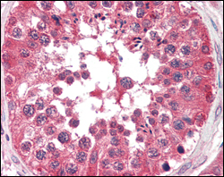 Immunohistochemical analysis of paraffin-embedded human testis tissues using BRAF mouse mAb.