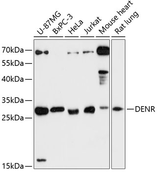 Western blot - DENR Polyclonal Antibody 