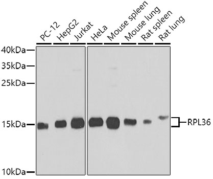 Western blot - RPL36 Polyclonal Antibody 
