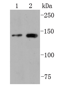 Fig1:; Western blot analysis of FGFR2 on different lysates. Proteins were transferred to a PVDF membrane and blocked with 5% BSA in PBS for 1 hour at room temperature. The primary antibody ( 1/500) was used in 5% BSA at room temperature for 2 hours. Goat Anti-Rabbit IgG - HRP Secondary Antibody (HA1001) at 1:200,000 dilution was used for 1 hour at room temperature.; Positive control:; Lane 1: MCF-7 cell lysate; Lane 2: Jurkat cell lysate