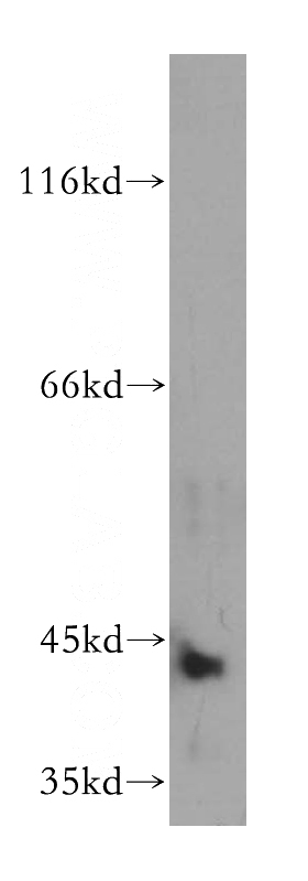 HepG2 cells were subjected to SDS PAGE followed by western blot with Catalog No:108175(ARSB antibody) at dilution of 1:300