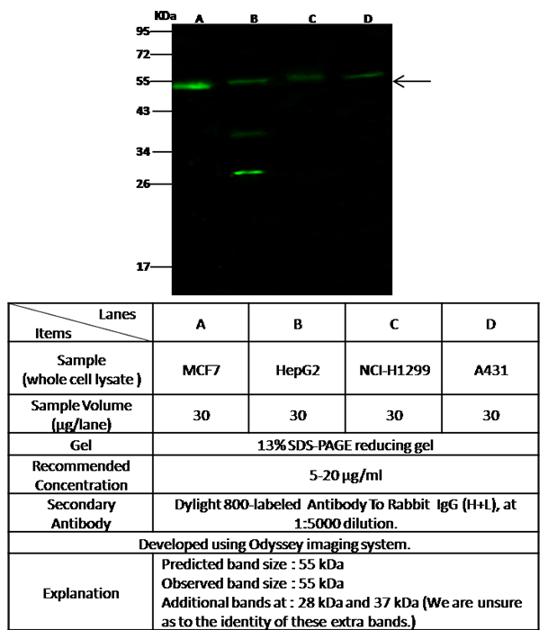 Human Estrogen Related Receptor alpha Western blot (WB) 14887