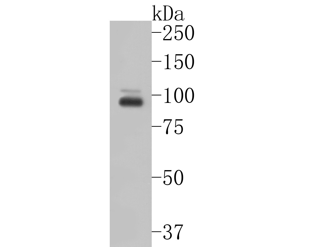 Fig1:; Western blot analysis of CLEC4F on SH-SY5Y cell lysates. Proteins were transferred to a PVDF membrane and blocked with 5% BSA in PBS for 1 hour at room temperature. The primary antibody ( 1/500) was used in 5% BSA at room temperature for 2 hours. Goat Anti-Mouse IgG - HRP Secondary Antibody (HA1006) at 1:5,000 dilution was used for 1 hour at room temperature.
