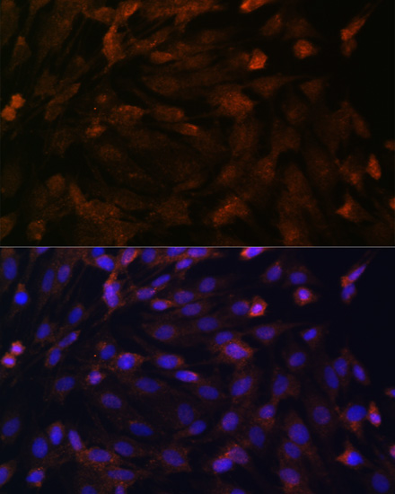 Immunofluorescence - PTCH1 Polyclonal Antibody 