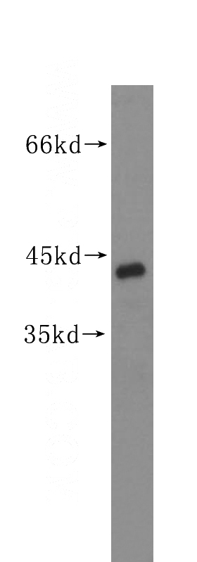 human heart tissue were subjected to SDS PAGE followed by western blot with Catalog No:112431(MAPK11 antibody) at dilution of 1:500