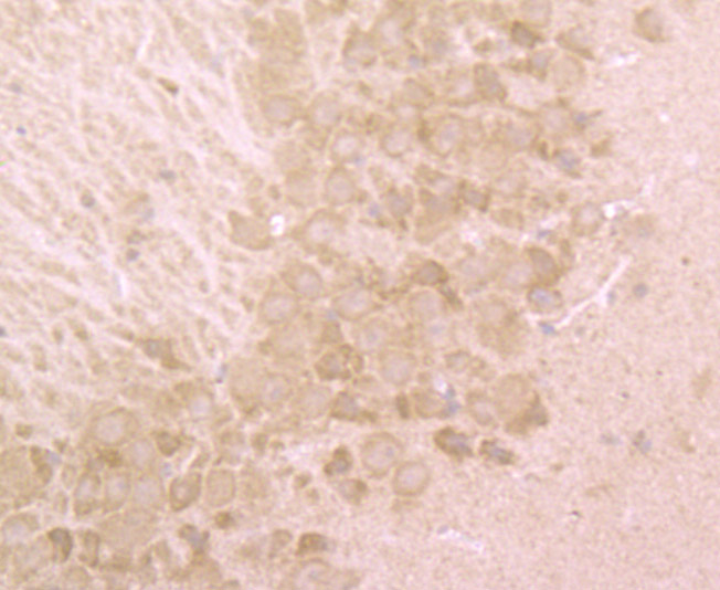 Fig4: Immunohistochemical analysis of paraffin-embedded mouse brain tissue using anti-BHLHB9 antibody. Counter stained with hematoxylin.