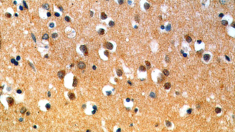 Immunohistochemical of paraffin-embedded human brain using Catalog No:115247(SIRT6 antibody) at dilution of 1:50 (under 40x lens)