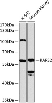Western blot - RARS2 Polyclonal Antibody 