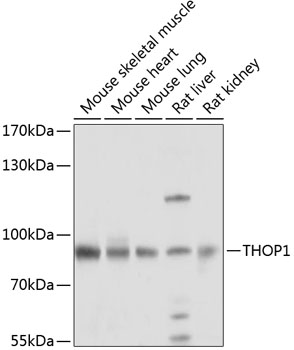 Western blot - THOP1 Polyclonal Antibody 