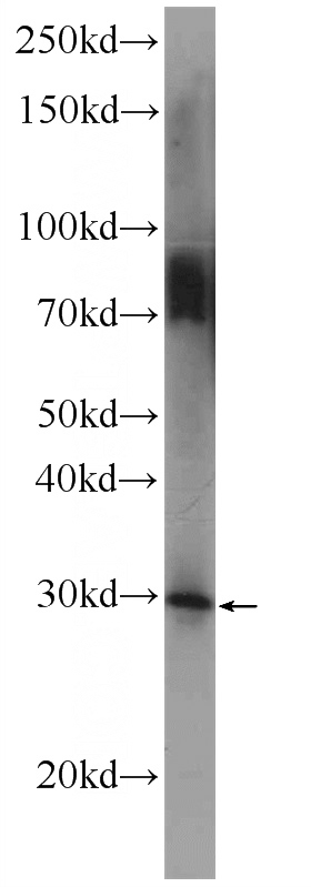 rat testis tissue were subjected to SDS PAGE followed by western blot with Catalog No:113327(ODF3 Antibody) at dilution of 1:600
