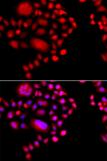Immunofluorescence - POLR1D Polyclonal Antibody 