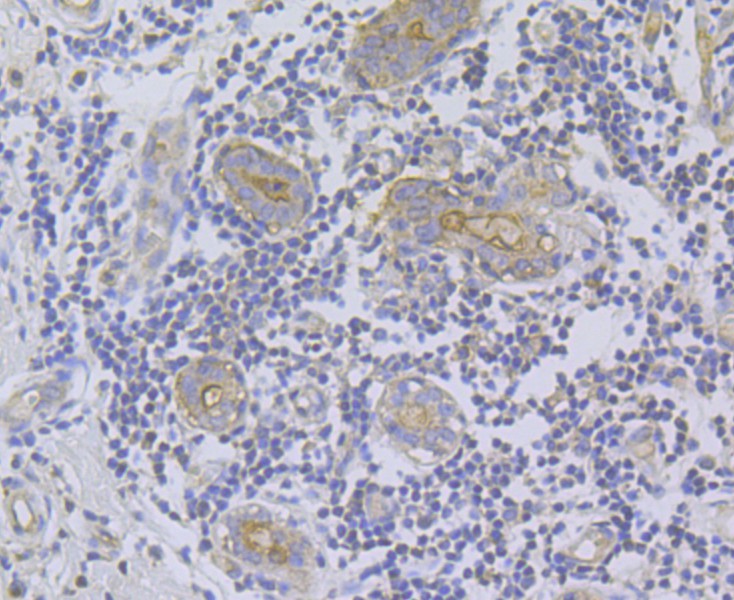 Fig7: Immunohistochemical analysis of paraffin-embedded human breast tissue using anti-ITPR2 antibody. Counter stained with hematoxylin.