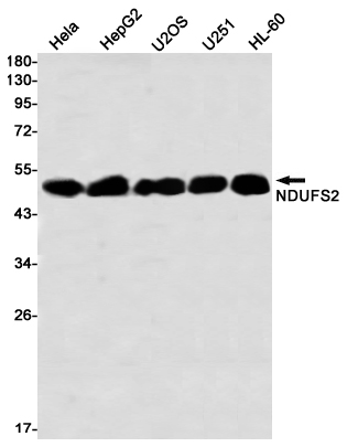 Western blot detection of NDUFS2 in Hela,HepG2,U2OS,U251,HL-60 using NDUFS2 Rabbit mAb(1:1000 diluted)