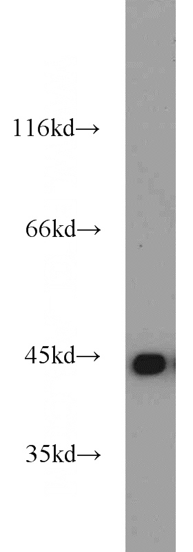 HeLa cells were subjected to SDS PAGE followed by western blot with Catalog No:113784(PGK1 antibody) at dilution of 1:1200