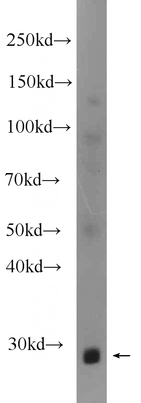 human skeletal muscle tissue were subjected to SDS PAGE followed by western blot with Catalog No:110787(FTSJ2 Antibody) at dilution of 1:600