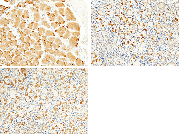 FGFR4 / CD334 Antibody, Rabbit PAb, Antigen Affinity Purified, Immunohistochemistry