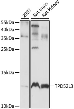 Western blot - TPD52L3 Polyclonal Antibody 