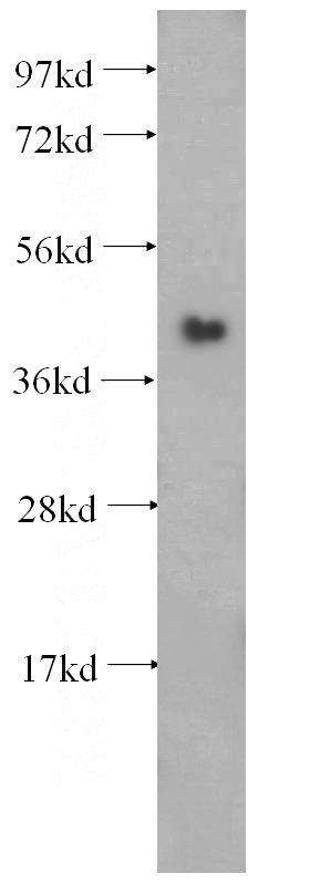 mouse skeletal muscle tissue were subjected to SDS PAGE followed by western blot with Catalog No:115204(SERPINB6 antibody) at dilution of 1:500