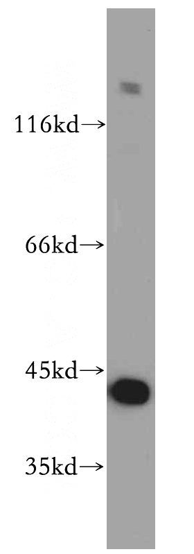 MCF7 cells were subjected to SDS PAGE followed by western blot with Catalog No:110684(FKBPL antibody) at dilution of 1:500