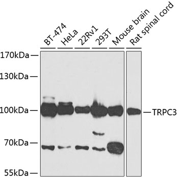 Western blot - TRPC3 Polyclonal Antibody 