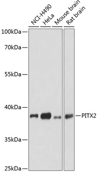 Western blot - PITX2 Polyclonal Antibody 