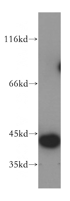 mouse uterus tissue were subjected to SDS PAGE followed by western blot with Catalog No:110090(DNAJB12 antibody) at dilution of 1:500