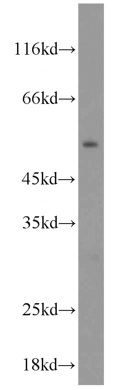 mouse liver tissue were subjected to SDS PAGE followed by western blot with Catalog No:113340(OLFM3 antibody) at dilution of 1:500