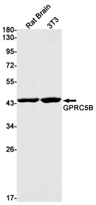 Western blot detection of GPRC5B in Rat Brain,3T3 cell lysates using GPRC5B Rabbit mAb(1:1000 diluted).Predicted band size:45kDa.Observed band size:45kDa.