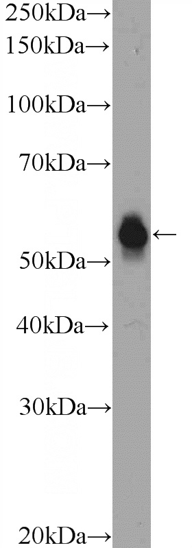 COLO 320 cells were subjected to SDS PAGE followed by western blot with Catalog No:115940(TEKT5 Antibody) at dilution of 1:1000