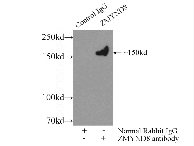 IP Result of anti-ZMYND8 (IP:Catalog No:116943, 3ug; Detection:Catalog No:116943 1:300) with HeLa cells lysate 920ug.