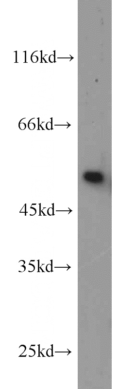 mouse testis tissue were subjected to SDS PAGE followed by western blot with Catalog No:108376(TTC8 antibody) at dilution of 1:300