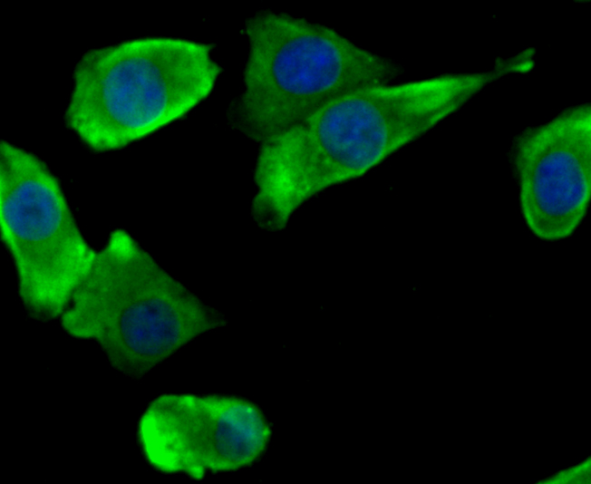Fig2: ICC staining NaV1.7 in A549 cells (green). The nuclear counter stain is DAPI (blue). Cells were fixed in paraformaldehyde, permeabilised with 0.25% Triton X100/PBS.