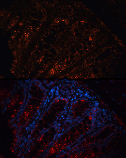 Immunofluorescence - APC Polyclonal Antibody 