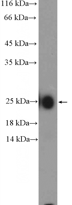 human plasma (0.3ug) tissue were subjected to SDS PAGE followed by western blot with Catalog No:111692(IgG light chain (Kappa) Antibody) at dilution of 1:1000