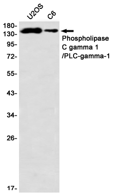 Western blot detection of Phospholipase C gamma 1/PLC-gamma-1 in U2OS,C6 using Phospholipase C gamma 1/PLC-gamma-1 Rabbit mAb(1:1000 diluted)