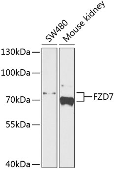 Western blot - FZD7 Polyclonal Antibody 