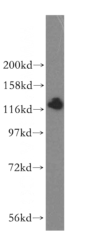 mouse kidney tissue were subjected to SDS PAGE followed by western blot with Catalog No:111354(HIP1R antibody) at dilution of 1:600