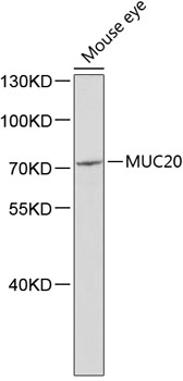 Western blot - MUC20 Polyclonal Antibody 