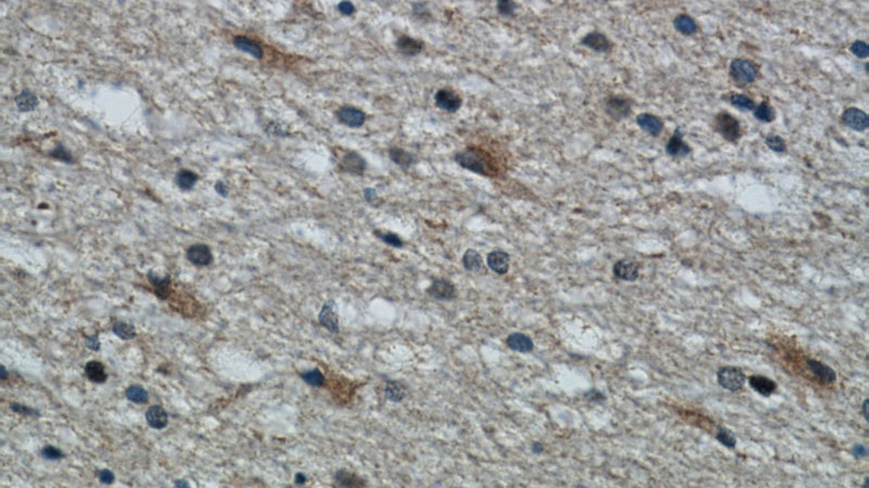 Immunohistochemical of paraffin-embedded human brain using Catalog No:111583(IBA1 antibody) at dilution of 1:50 (under 40x lens)