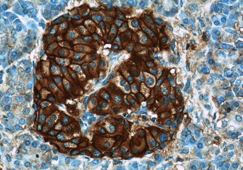 Immunohistochemistry of paraffin-embedded human pancreas slide using Catalog No:109088(CD99 Antibody) at dilution of 1:50 (under 40x lens)